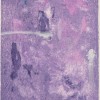 Towns man-hope31